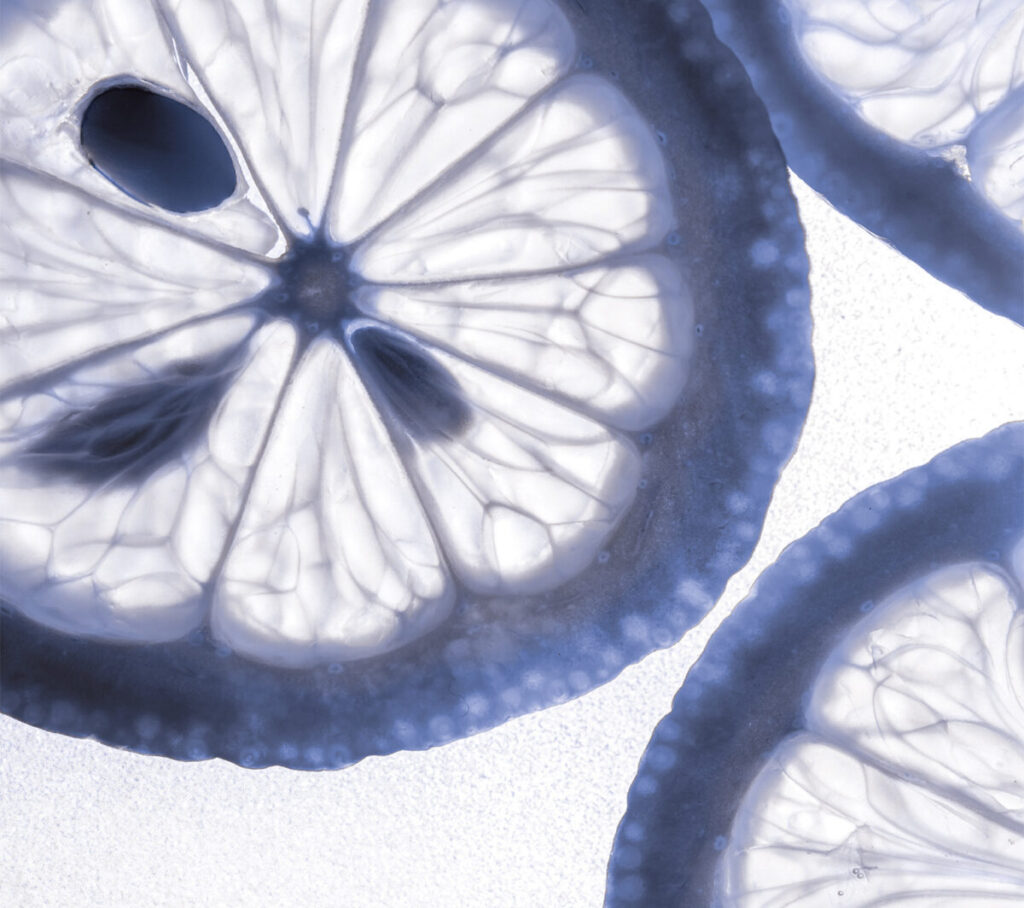 Defect details: Metal detection vs. X-ray